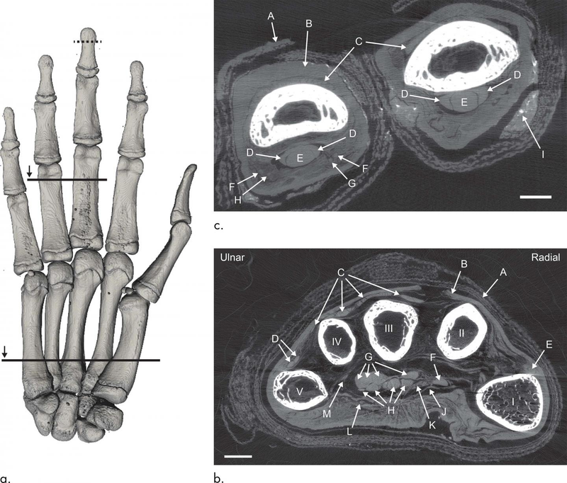 (a) top view of the skeletal hand; (b) cross-sections of the hand showing interior detail.